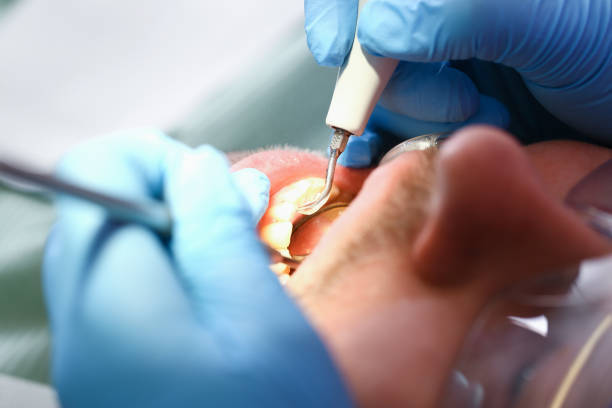Best Emergency TMJ Treatment in Newark, OH